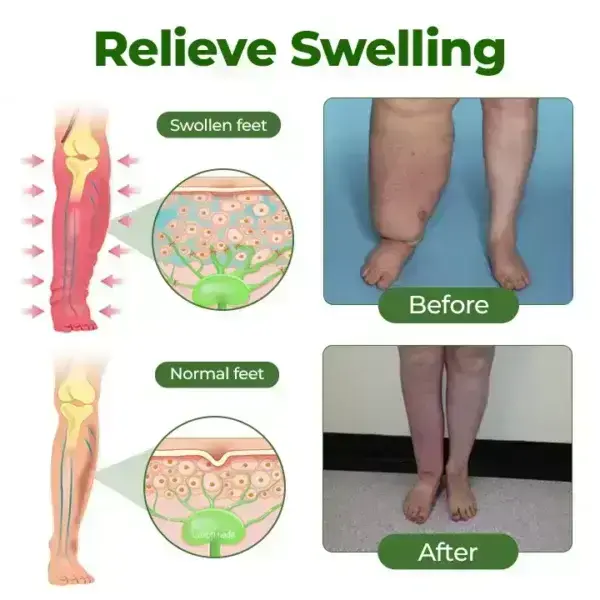 Professional Leg Circulation Cream - Image 5