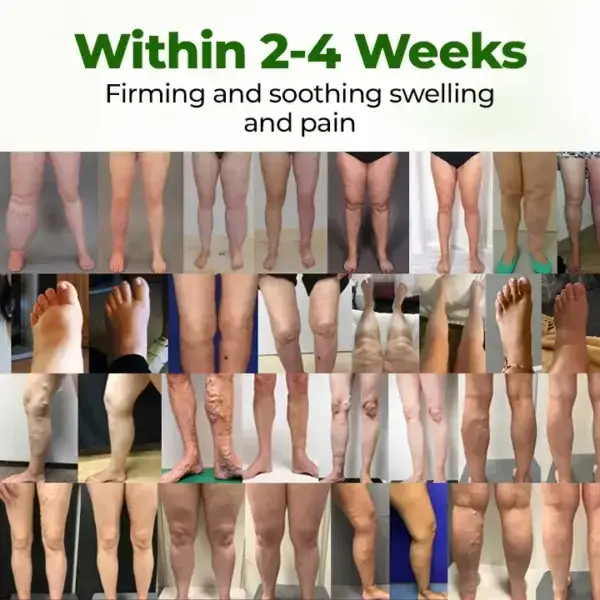 Professional Leg Circulation Cream - Image 3