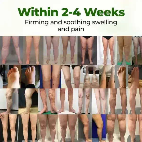 Professional Leg Circulation Cream - Image 3