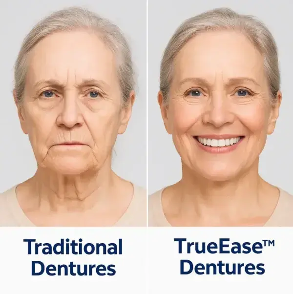 TrueEase Dentures - Image 5