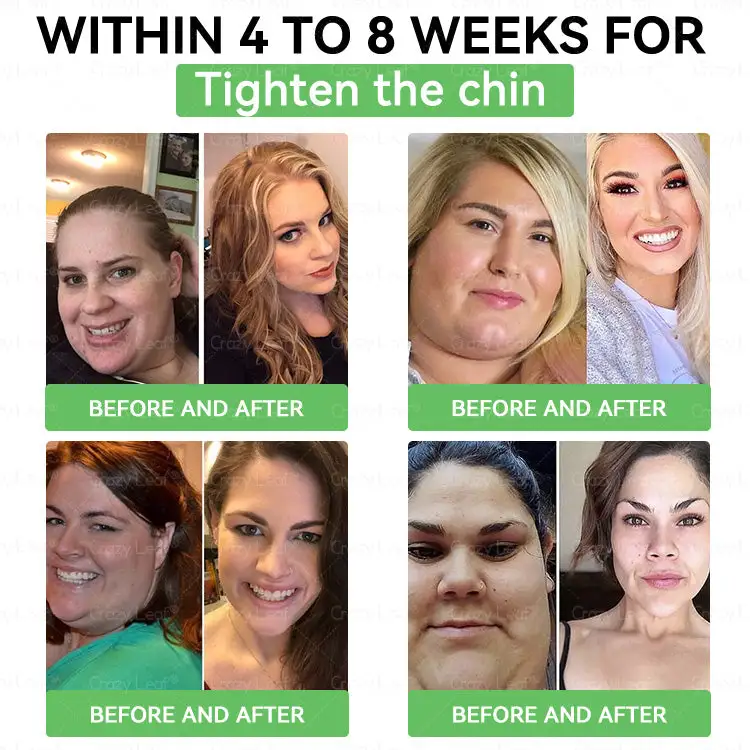 ๐บ๐๐๐๐๐๐๐ ๐ฎ๐๐บ๐
๐๐ข๐ช๐ฎ๐ข๐ - Image 14