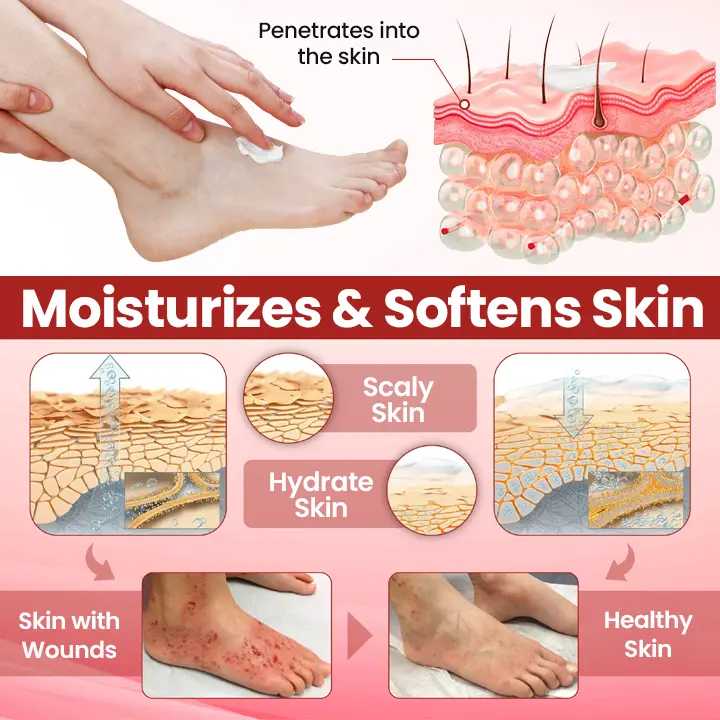 Diabetic Care Cream - Image 8