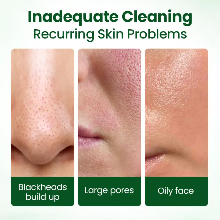 Avocado Acid Mask - Image 8