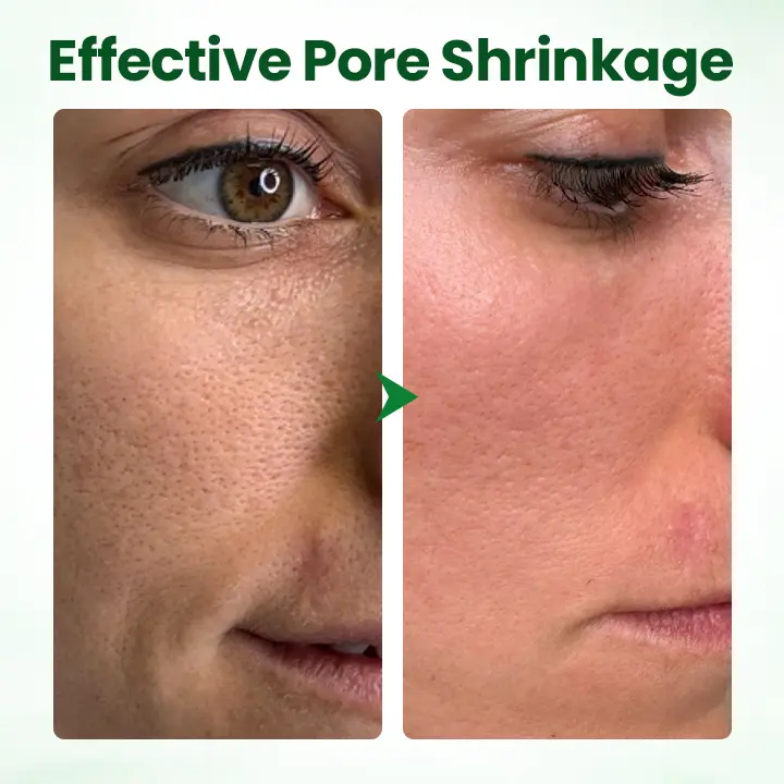 Avocado Acid Mask - Image 10