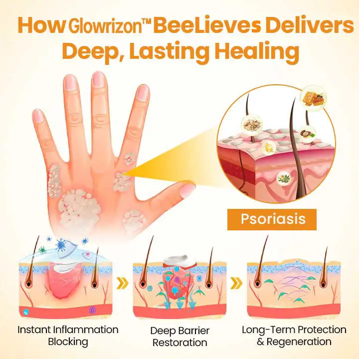 BeeLieves Psoriasis Repair Ointment - Image 4