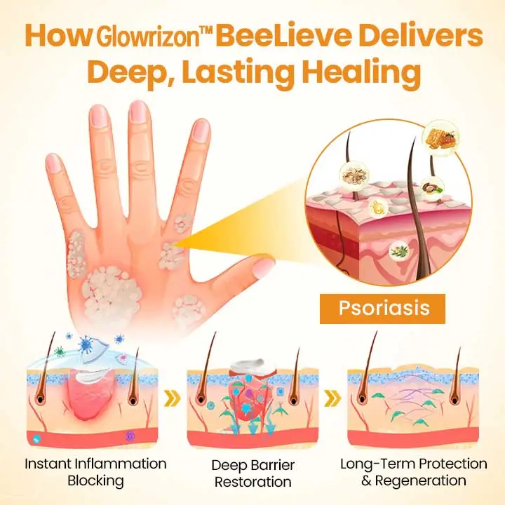 BeeLieves Psoriasis Repair Ointment - Image 6