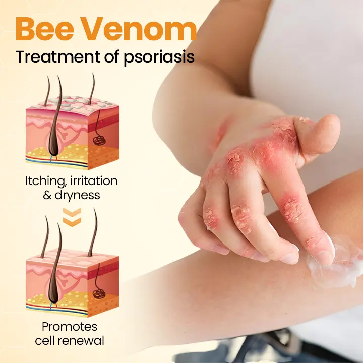 BeeLieves Psoriasis Repair Ointment - Image 7