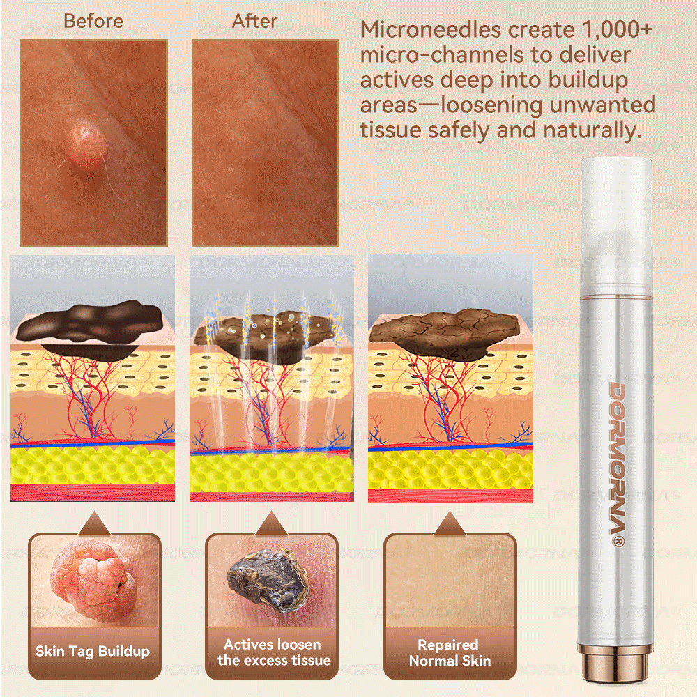 ๐๐ญ๐๐ฆ ๐๐๐ฅ๐ฅ ๐๐๐๐ ๐๐๐ฉ๐๐ข๐ซ ๐๐ข๐ฅ๐ค - Image 9