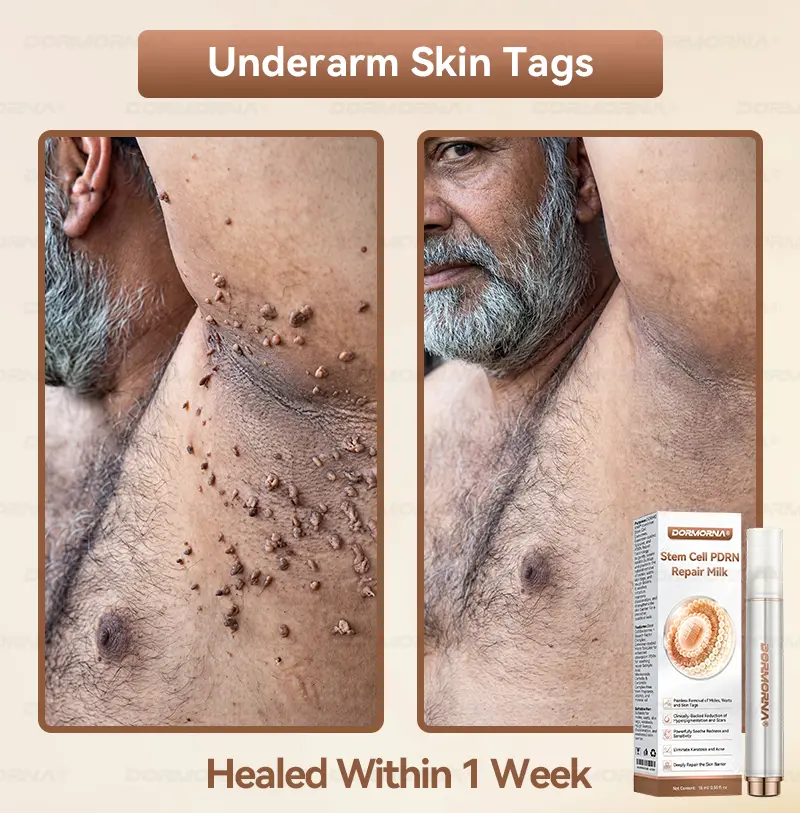 ๐๐ญ๐๐ฆ ๐๐๐ฅ๐ฅ ๐๐๐๐ ๐๐๐ฉ๐๐ข๐ซ ๐๐ข๐ฅ๐ค - Image 5