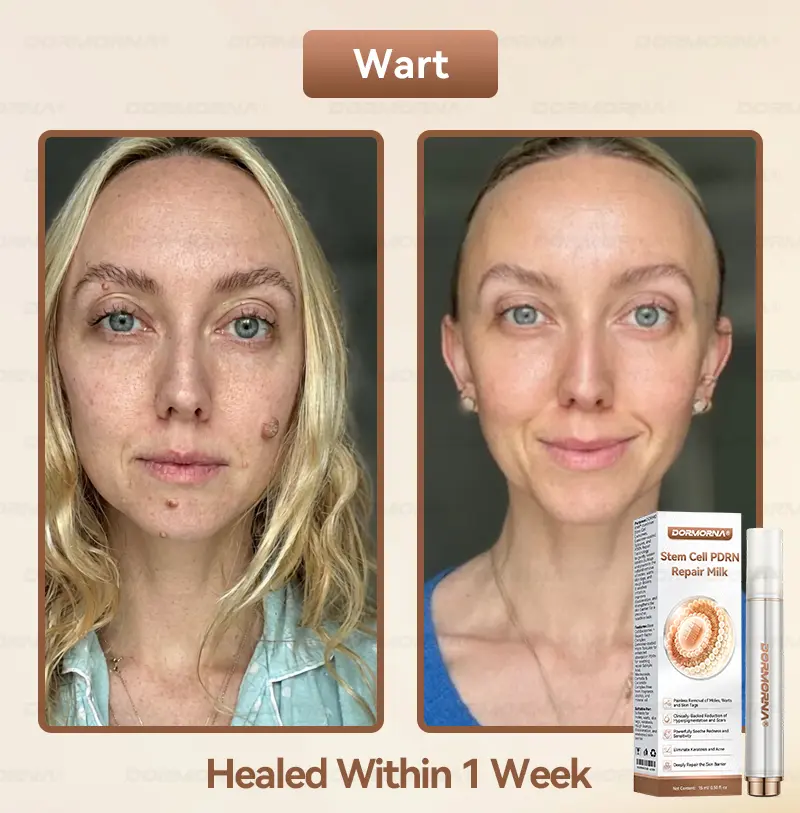 ๐๐ญ๐๐ฆ ๐๐๐ฅ๐ฅ ๐๐๐๐ ๐๐๐ฉ๐๐ข๐ซ ๐๐ข๐ฅ๐ค