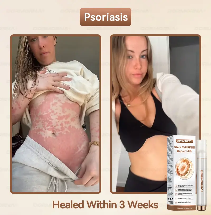 ๐๐ญ๐๐ฆ ๐๐๐ฅ๐ฅ ๐๐๐๐ ๐๐๐ฉ๐๐ข๐ซ ๐๐ข๐ฅ๐ค - Image 2