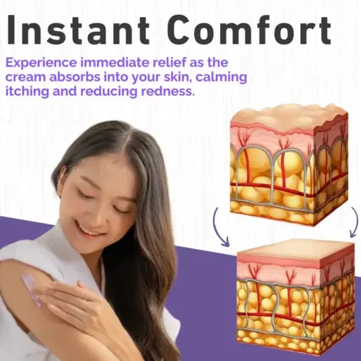 Violet Eczema Treatment Cream - Image 6