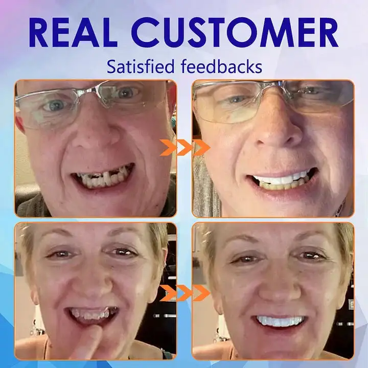 New Generation Flexible Full Denture Solution - Image 10