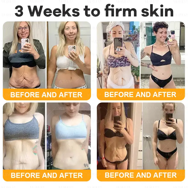 Bee Venom Skin Restoration Cream - Image 2