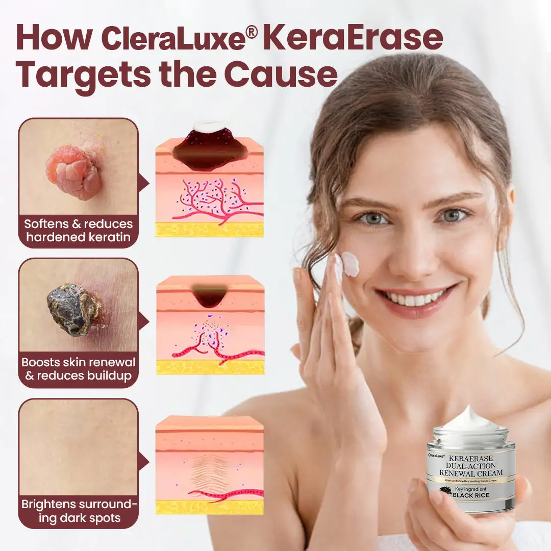 KeraErase Dual-Action Renewal Cream - Image 7