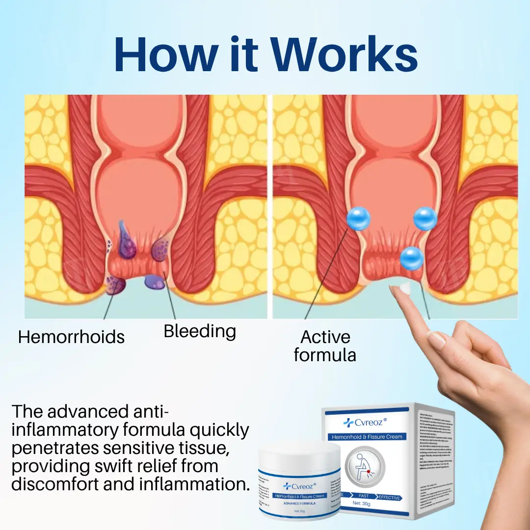 Hemorrhoid & Fissure Cream - Image 3