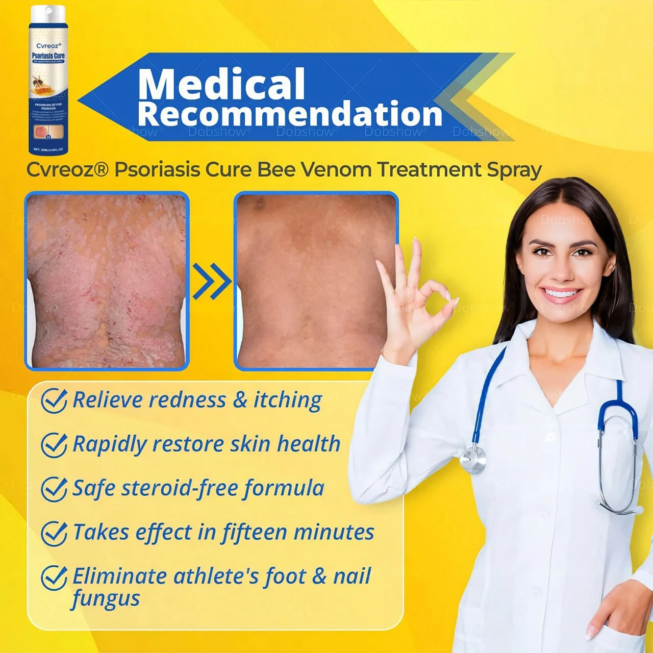 Psoriasis Cure Bee Venom Treatment Spray - Image 10