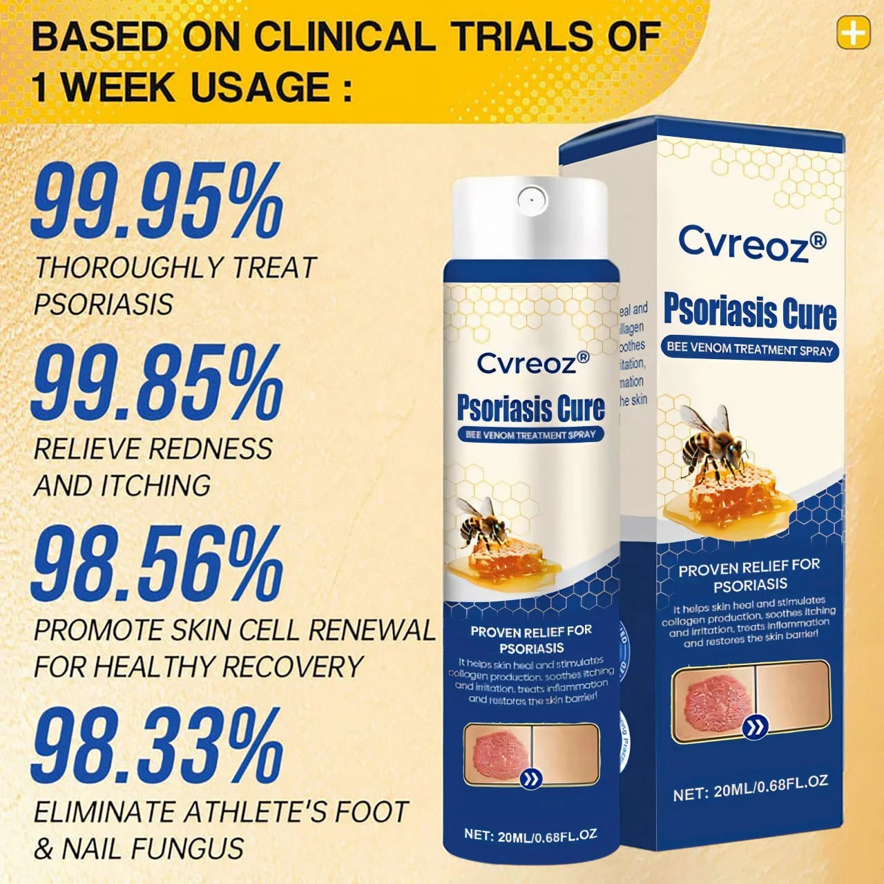 Psoriasis Cure Bee Venom Treatment Spray - Image 2