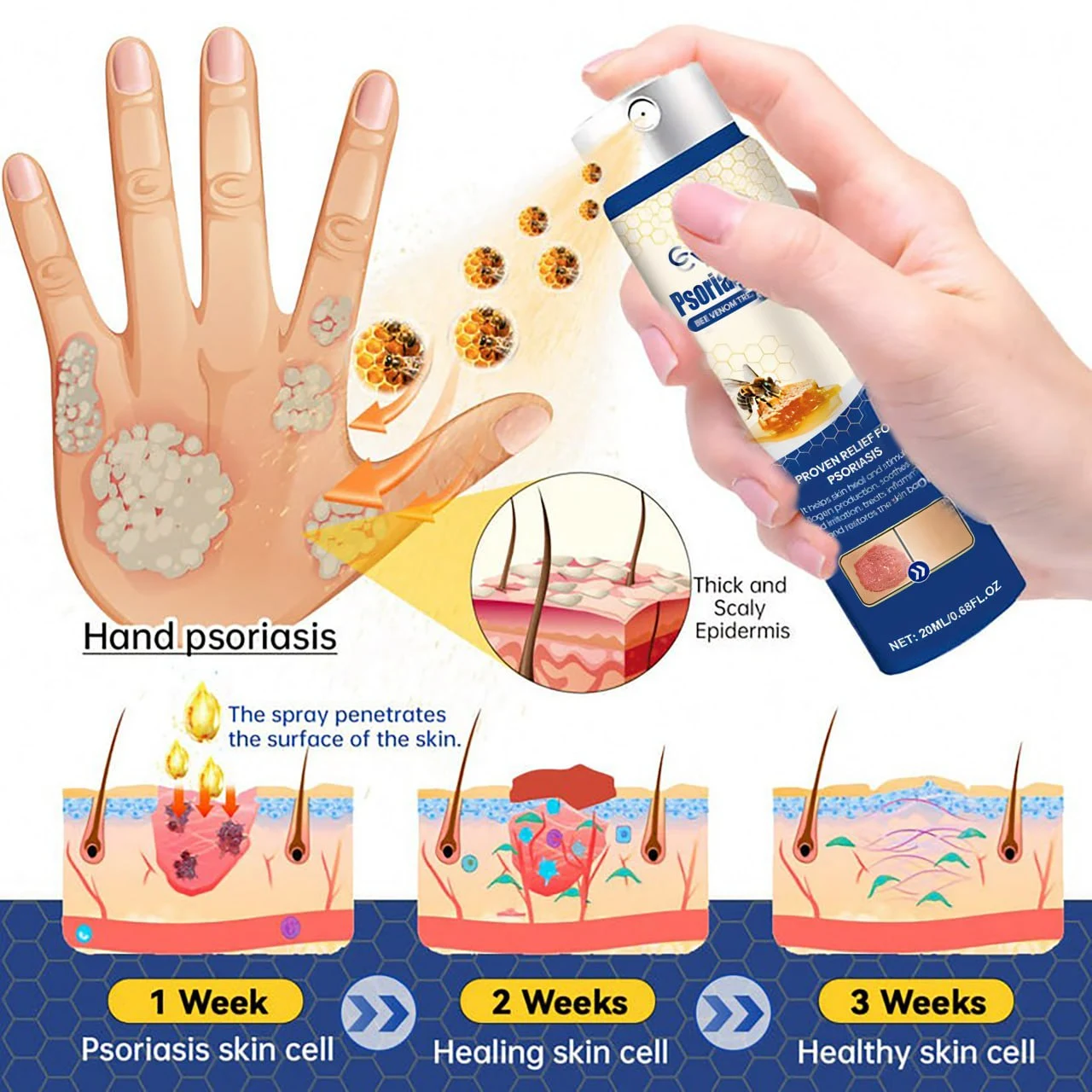 Psoriasis Cure Bee Venom Treatment Spray - Image 3