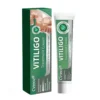 Vitiligo Treatment Cream