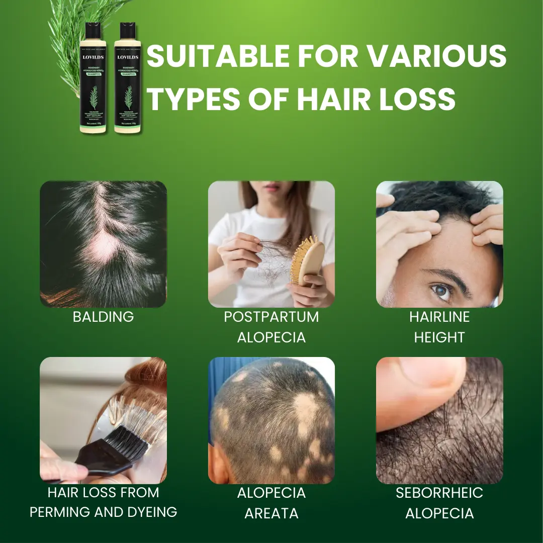 Rosemary Hydrolyzed Keratin Shampoo - Image 3