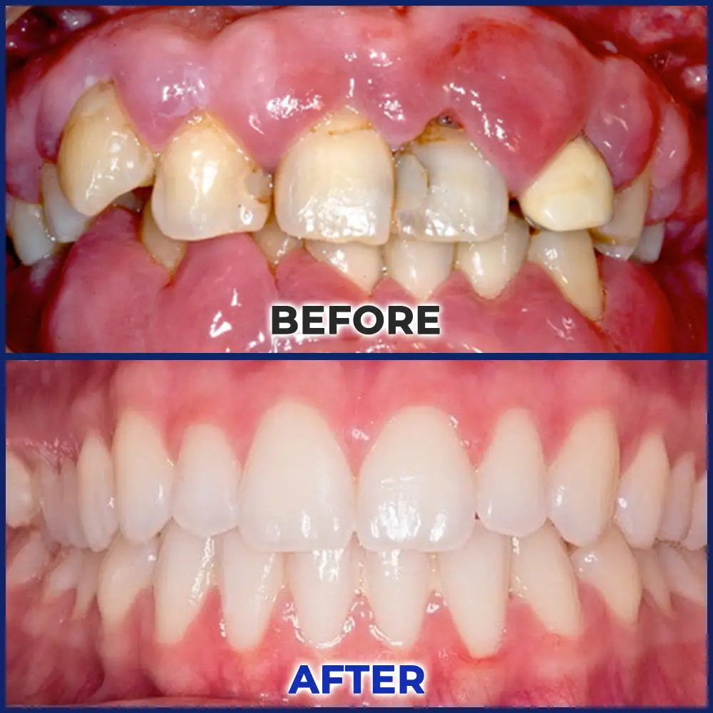 Bee Venom Dental Treatment Drops Mouthwash - Image 7