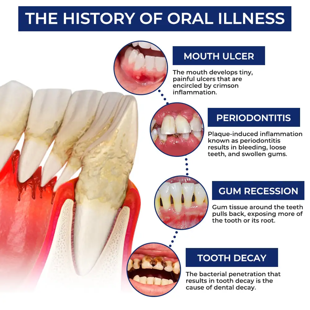 Bee Venom Dental Treatment Drops Mouthwash - Image 8