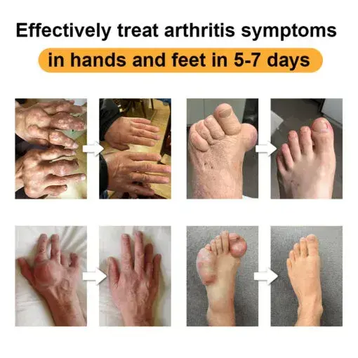 Joint & Bone Pain Foam Spray - Image 12