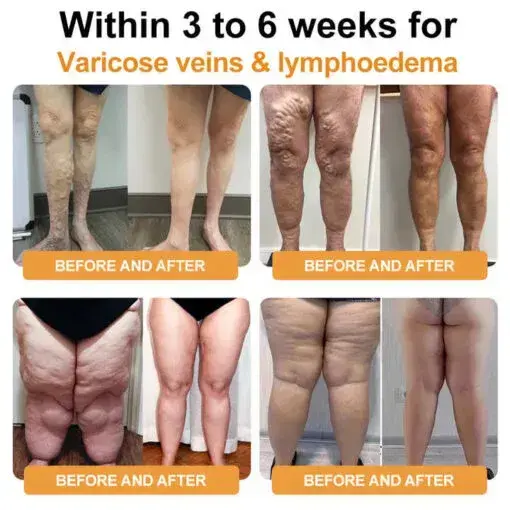 Joint & Bone Pain Foam Spray - Image 13