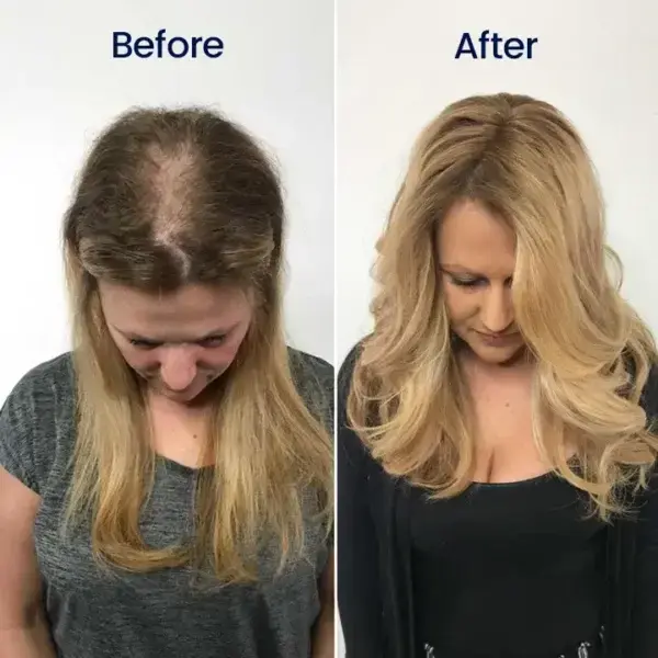 Maximum Strength 5% Minoxidil Fast-Action Hair Growth Serum - Image 12