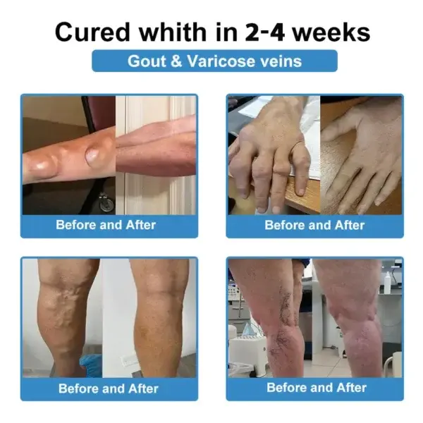 Nano-Microneedle Joint Patch - Image 5