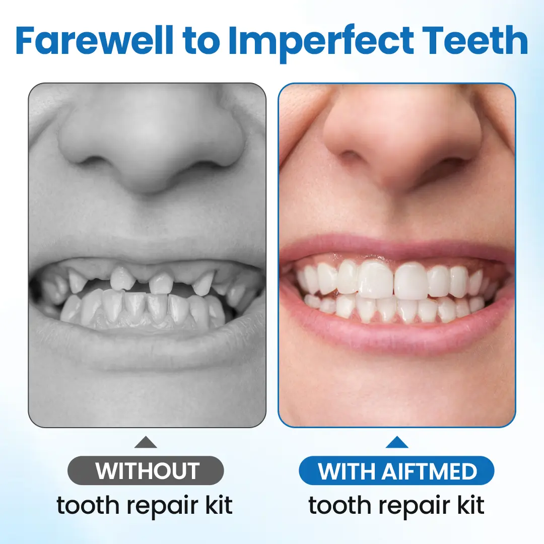 Tooth Repair Filling Kit - Image 7