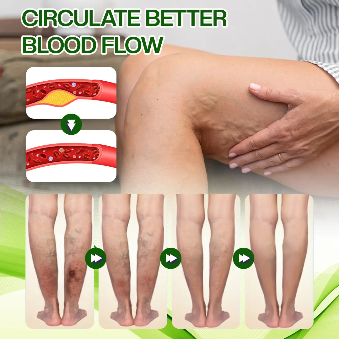 Horse Chestnut Edema Cream - Image 9