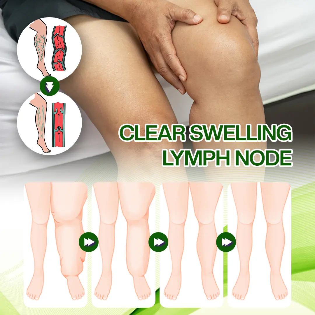 Horse Chestnut Edema Cream - Image 8