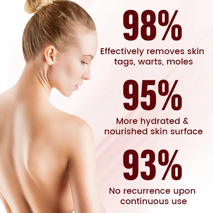 Vionara Nano WartErase Patch - Image 2