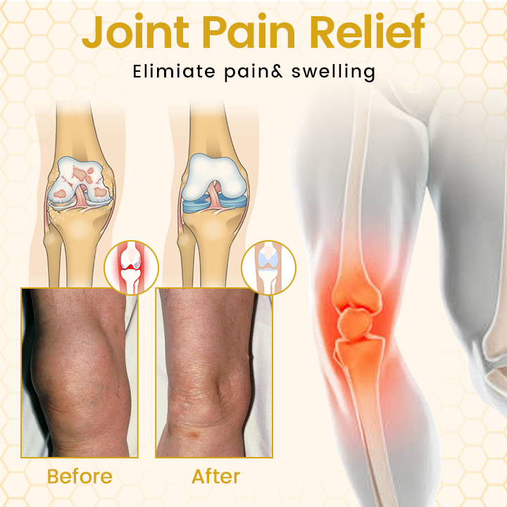 Bee Therapy Cream - Image 5