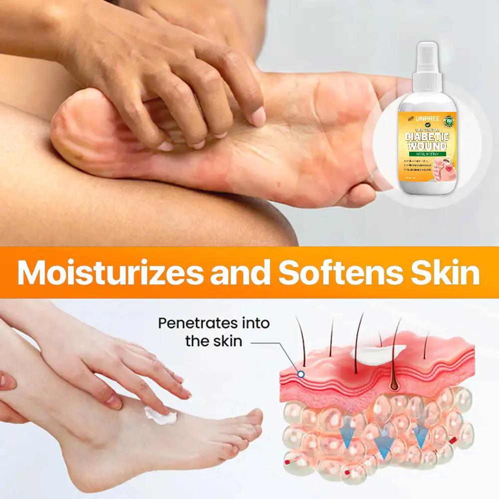 Bee Venom Diabetic Wound Kolirin Spray - Image 4