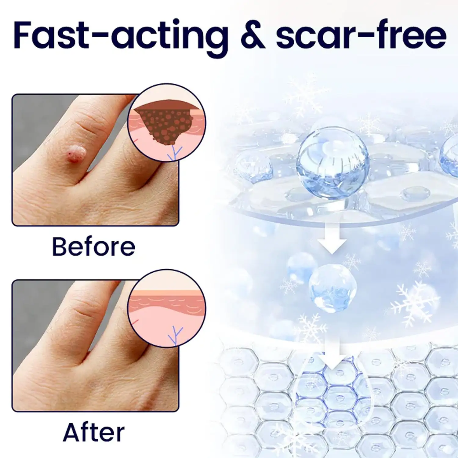 Cryo Freeze Spray - Image 7