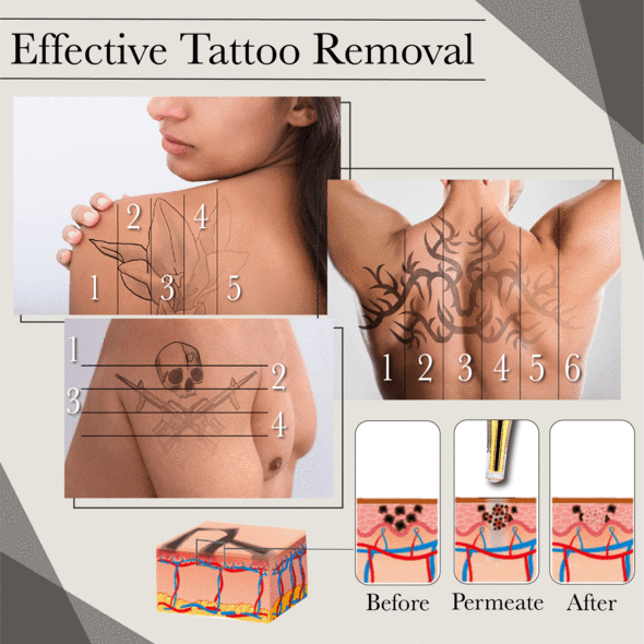 Natural Fading Tattoo Removal Cream - Image 3
