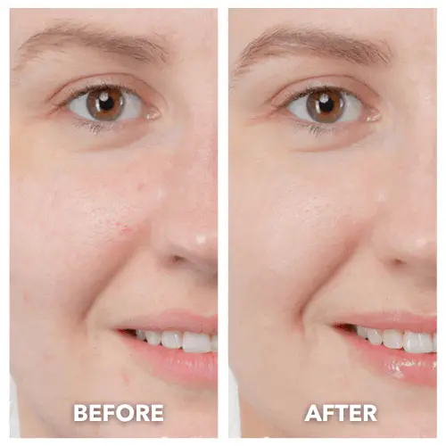 DermaLift 5-in-1 Facial Sculptor & Cleanser Device - Image 11