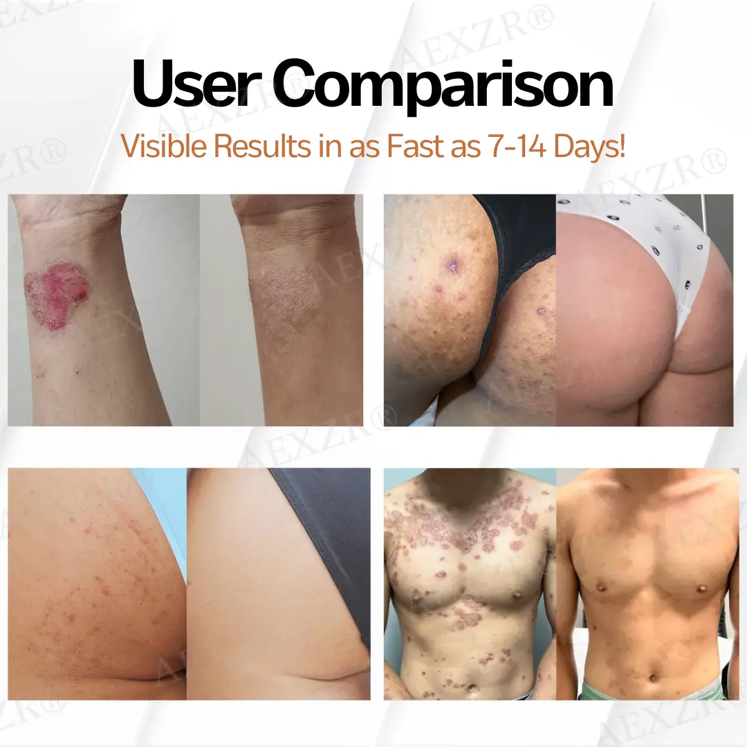 New Zealand Manuka Honey All-in-One Cream - Image 4