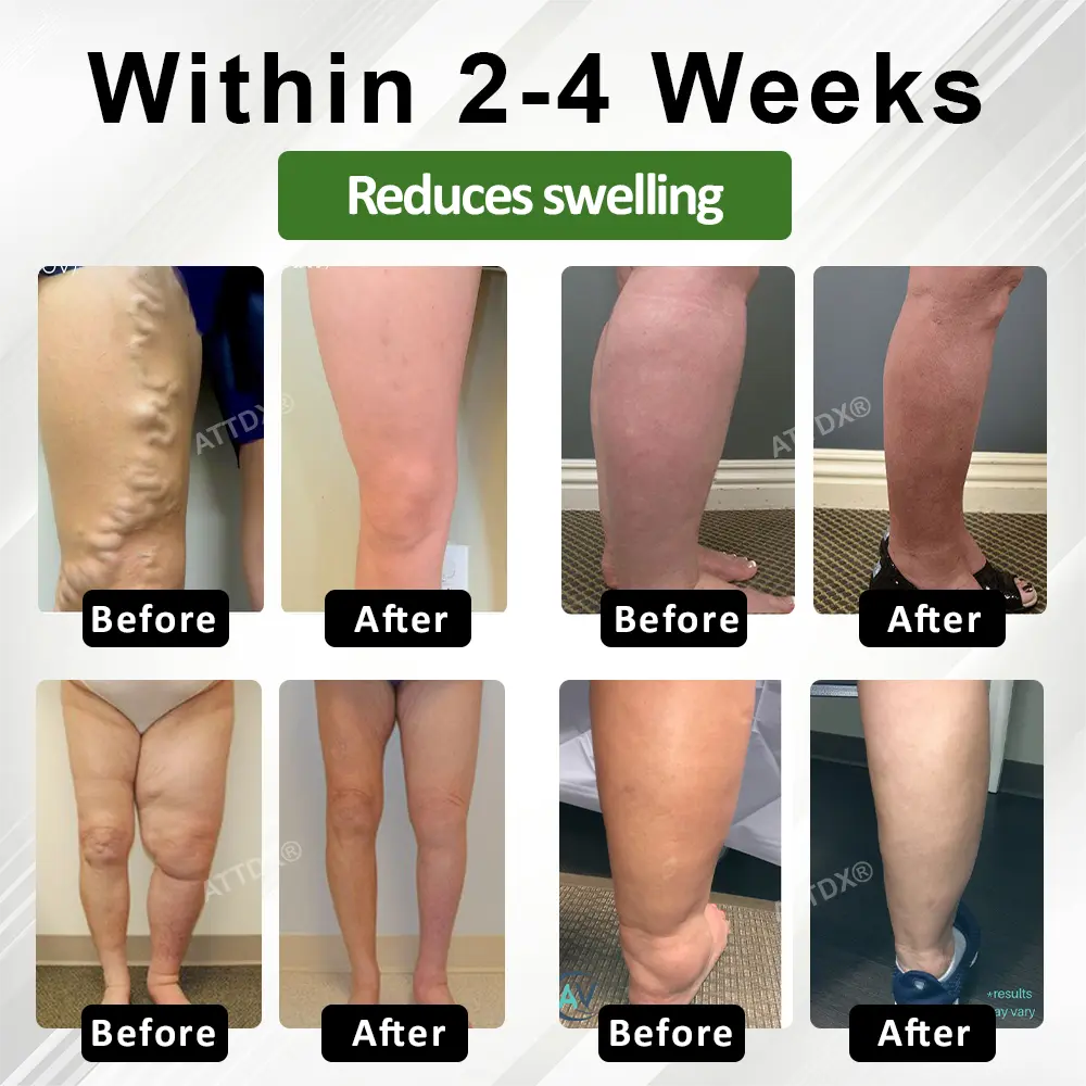 SpiculeFlow Advanced Edema Drainage Cream - Image 5