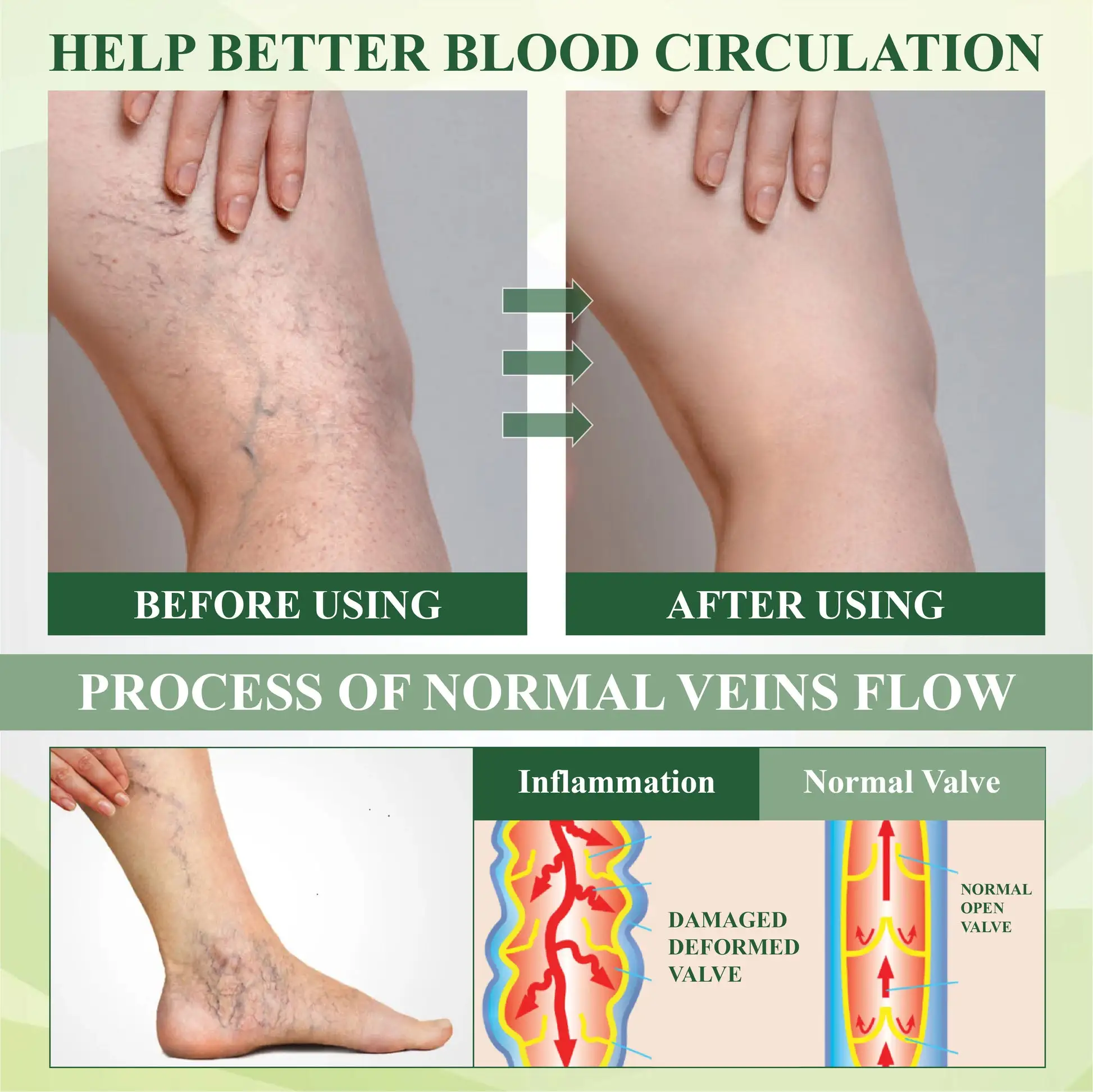 SpiculeFlow Advanced Edema Drainage Cream - Image 9