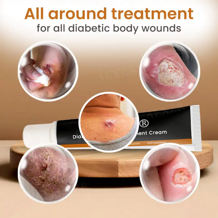 Advanced Wound Healing Cream for Diabetic Skin - Image 5