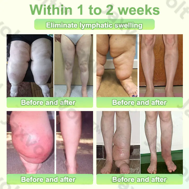 Natural Herbal Tourmaline Far Infrared Magnetic Therapy Foot Patches - Image 2