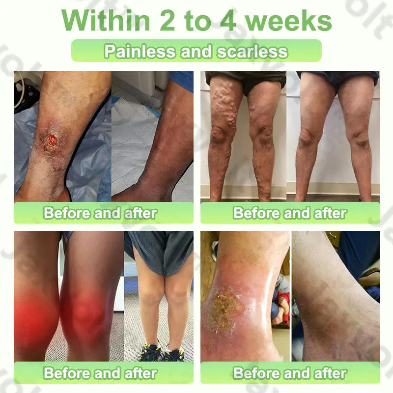 Natural Herbal Tourmaline Far Infrared Magnetic Therapy Foot Patches - Image 4