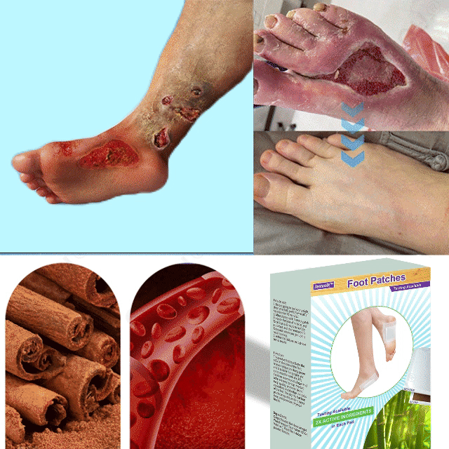 Natural Herbal Tourmaline Far Infrared Magnetic Therapy Foot Patches - Image 8