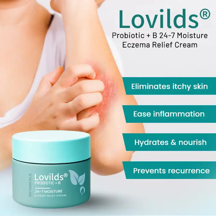 Probiotic + B 24-7 Moisture Eczema Relief Cream