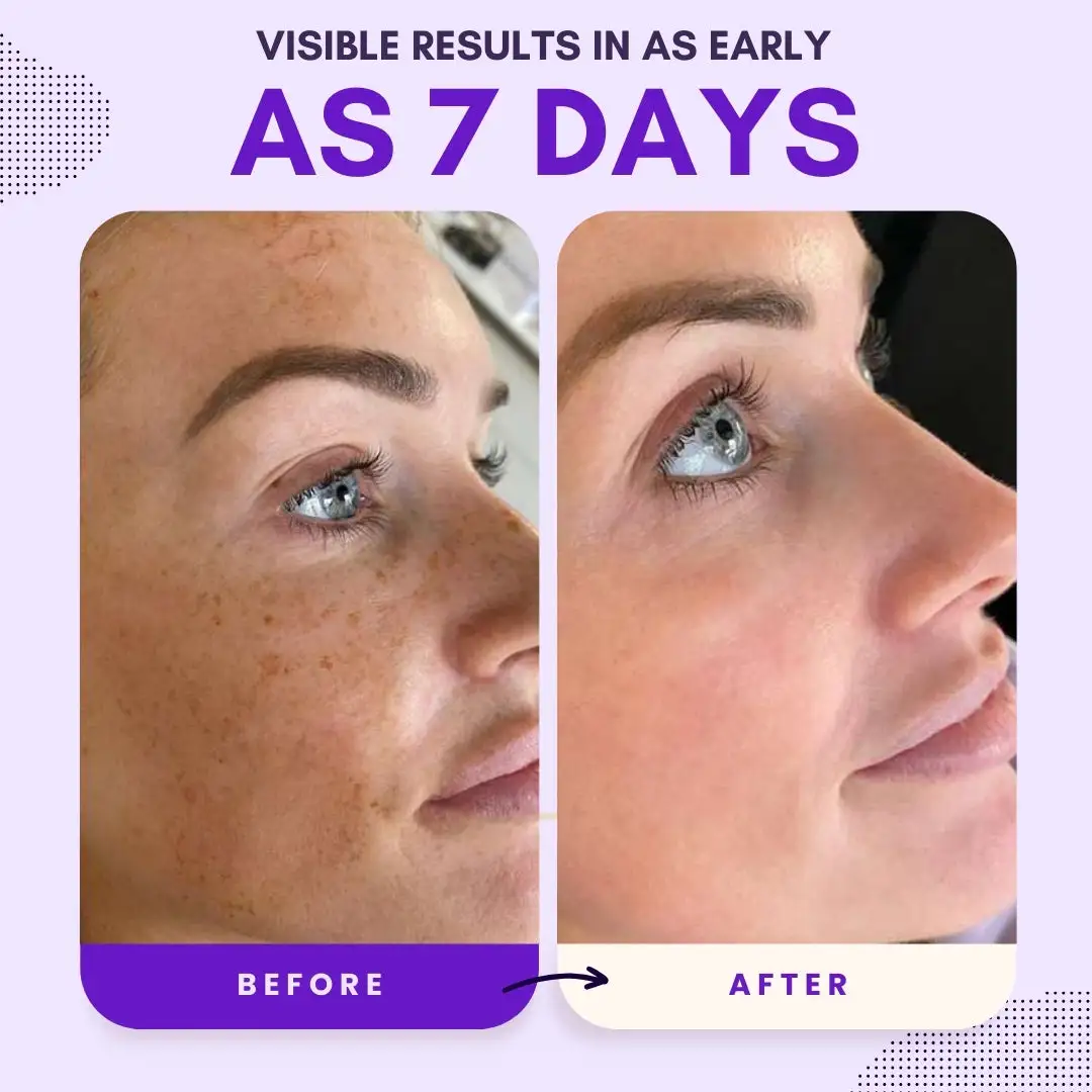 Thiamidol 630 Serum - Image 9