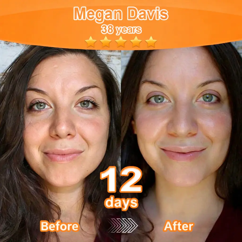 Stem Cell–Derived EGF & Copper Peptide Revitalising Essence Cream - Image 4